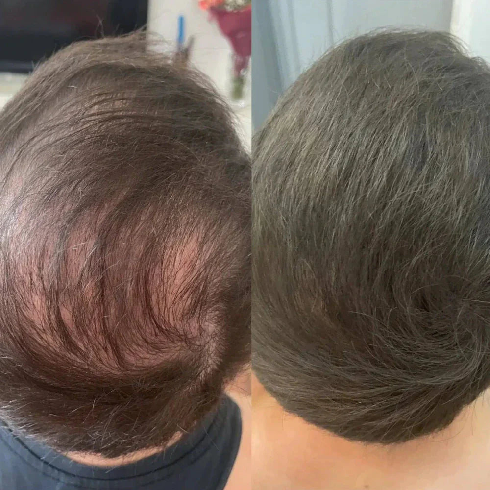 Nova Labs - Unisex Instant Hair Densifying Powder