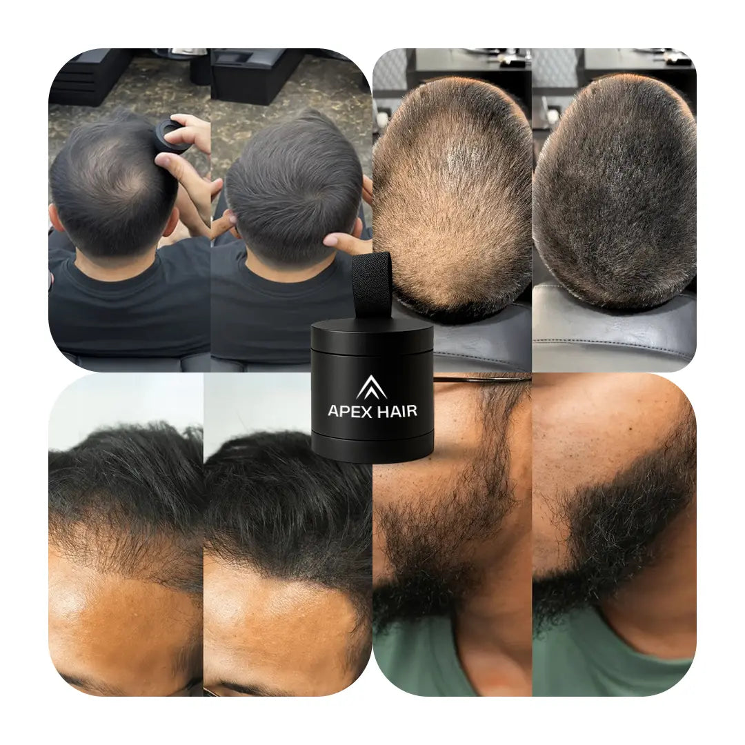 Nova Labs - Unisex Instant Hair Densifying Powder